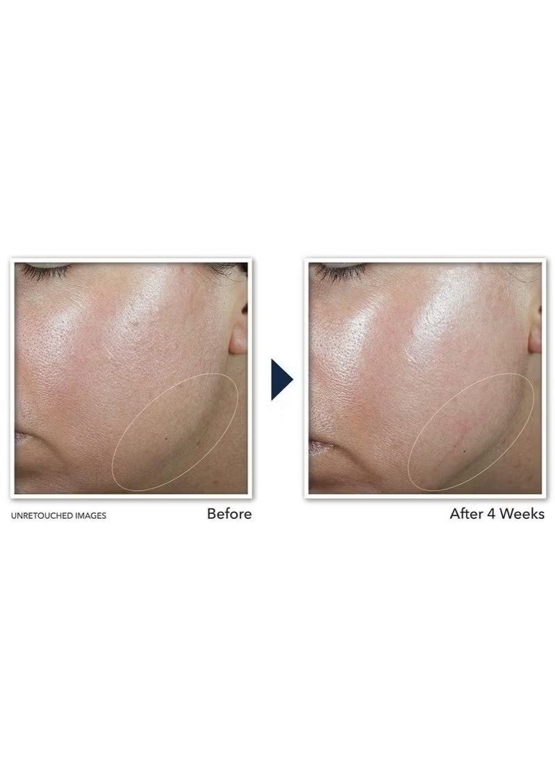 روك كريم شد الرقبة Derm Correxion مع حمض الهيالورونيك والريتينول المتقدم لشد الخطوط الأفقية في الرقبة بشكل مرئي، مرطب للوجه يعزز تجعيدات الوجه والرقبة والذقن، (1.7 أونصة) - Image 4